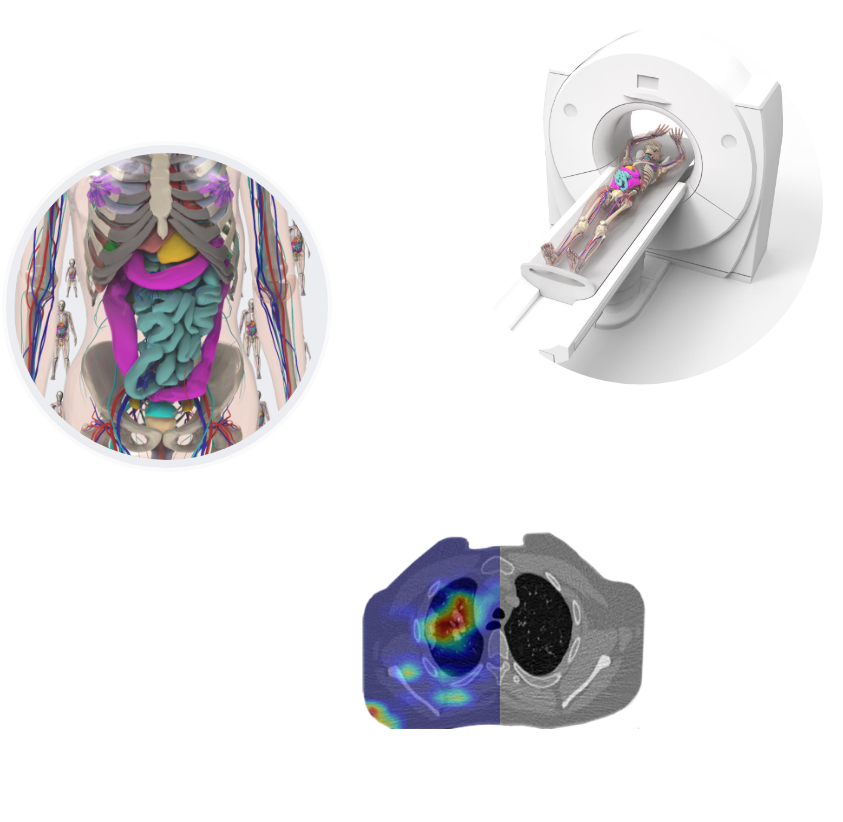 Three images showing anatomy of a phantom, ct scanner, and a heat map of scan