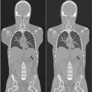 Simulated CT data for three male anatomies