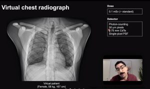 Virtual imaging study of phase-contrast chest radiography