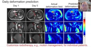 Development of Digital Phantoms for Radiation Therapy Applications