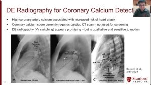 Coronary Artery Calcium Detection from  Dual-Energy Radiography